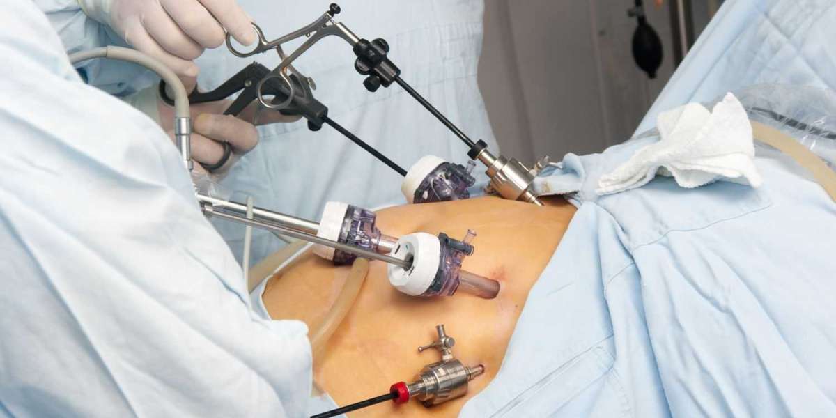 Bariatric Surgery Devices Market to Cross US$ 3.7 Billion by 2028
