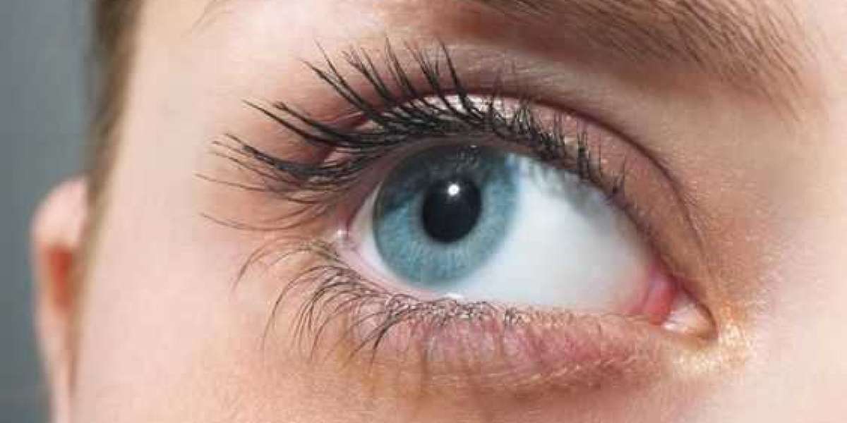 Careprost: Grow Your Confidence with Long and Stunning Eyelashes