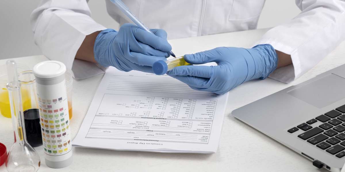 Cost of  COVID Antibody Test
