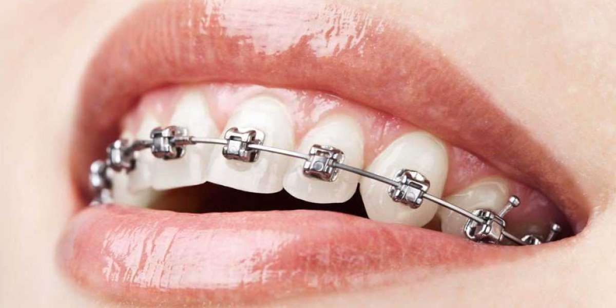 What to consider while taking Orthodontic Treatment in Mumbai?