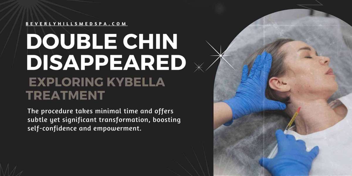Double Chin Disappeared: Exploring Kybella Treatment