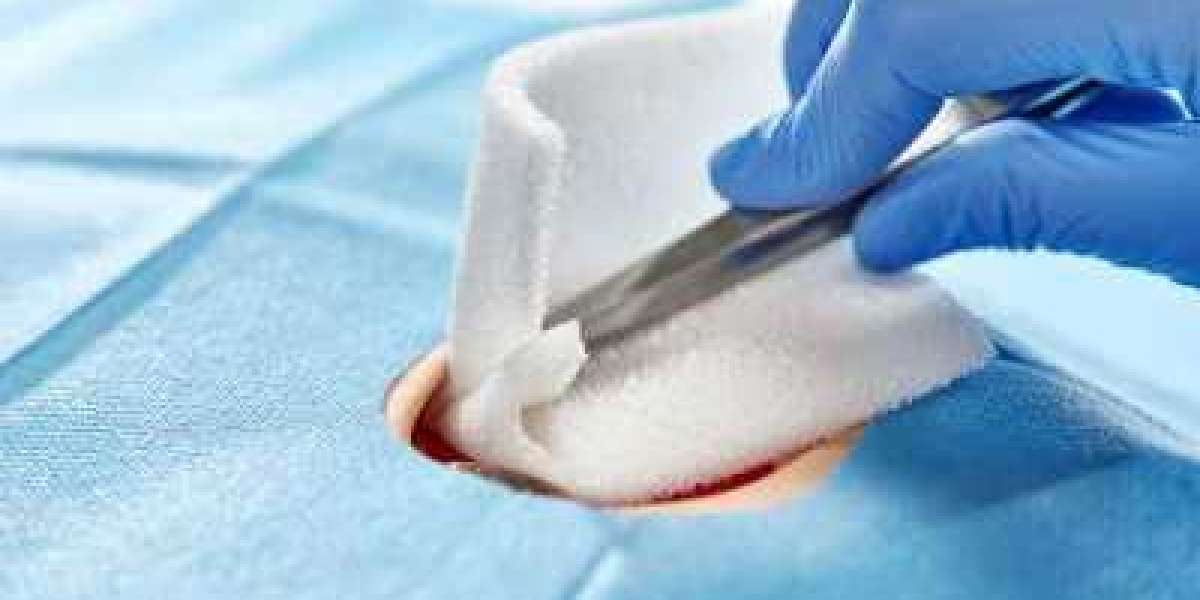 Medical Non-Woven Disposables Market to Hit $23260.95 Million By 2030
