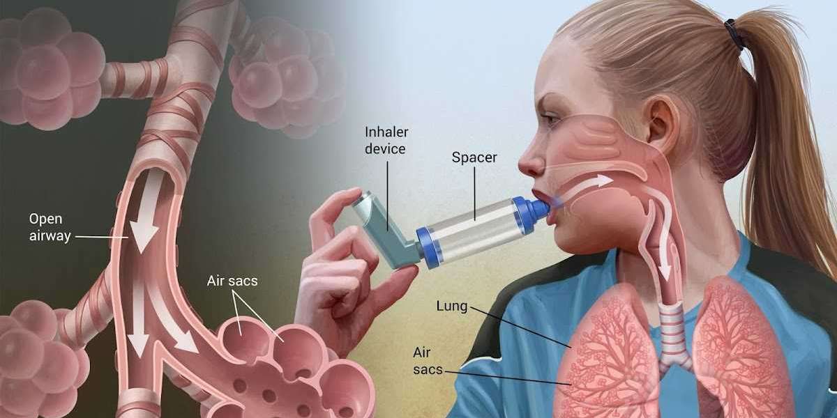 Global Asthma Inhaler Device Market Share & Upcoming Industry Growth | Report Covers Industry Insights on Regional C