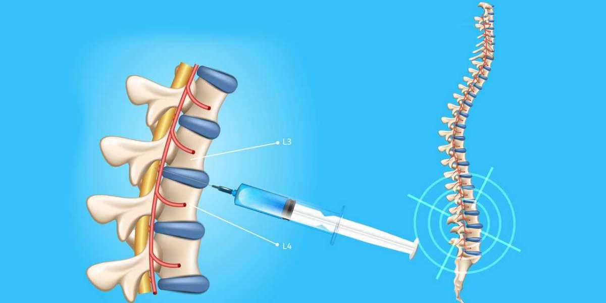 Spinal Needles Market  Share Grows Incredibly; Affirms MRFR