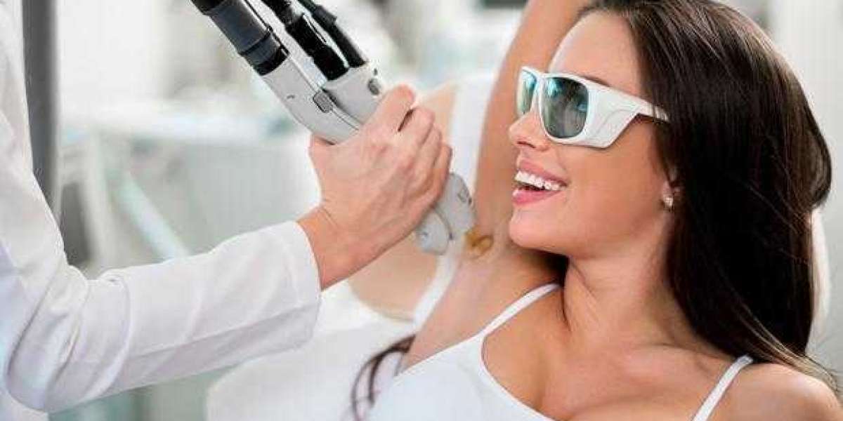 The Ultimate Guide to Laser Hair Removal in Mississauga