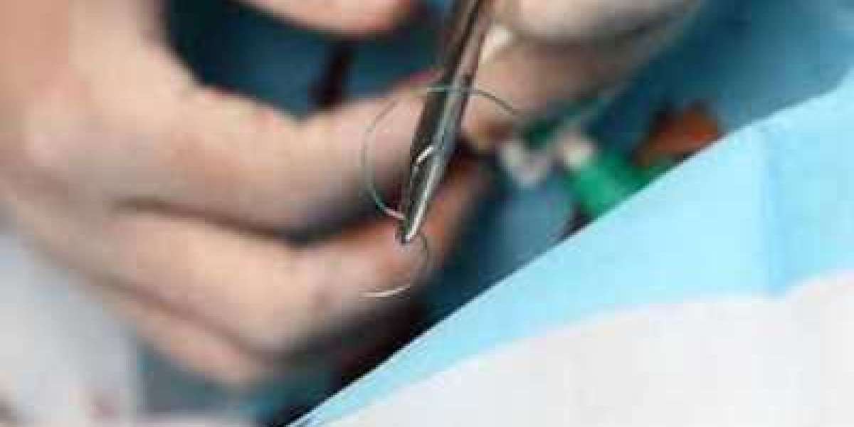 Surgical Stitching Products Market to Hit $6.13 Billion By 2030