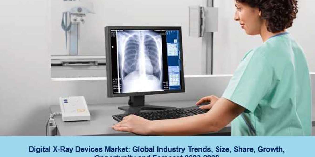 Digital X-Ray Devices Market 2023 | Industry Trends, Share and Forecast 2028