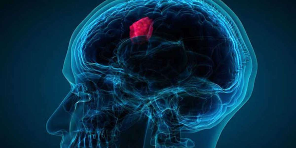 Pediatric Brain Tumor Market Share is Projected to Exhibit a CAGR of 6.8% during 2022-2030