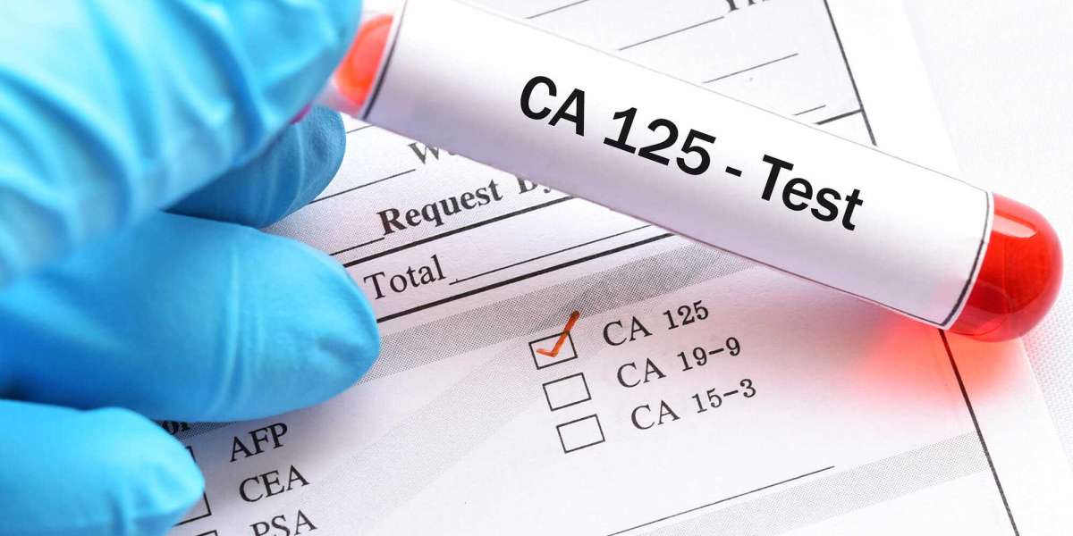 CA 125 Test Market Share to Witness Steady Rise in the Coming Decade