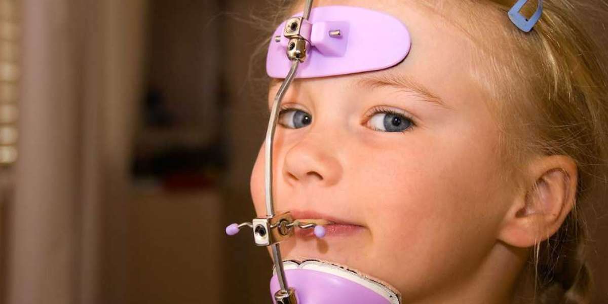 Orthodontic Headgear Market Share to Benefit from the Technologically Modern Solutions
