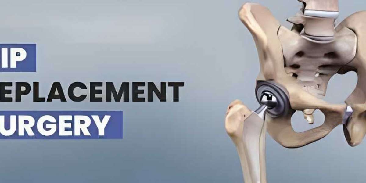Yapita Health offers total hip replacement in Turkey