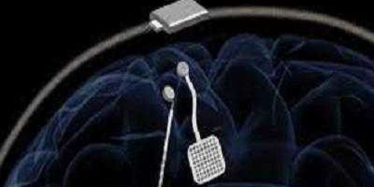 Brain Pacemaker Market to Hit $3.52 Billion By 2030