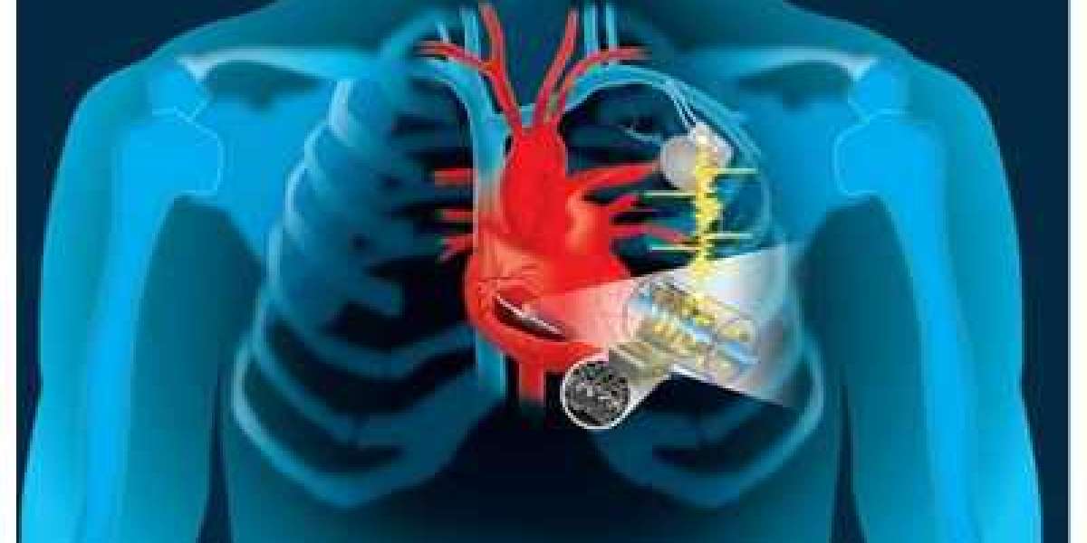 Structural Heart Devices Market to Hit $22.64 Billion By 2030