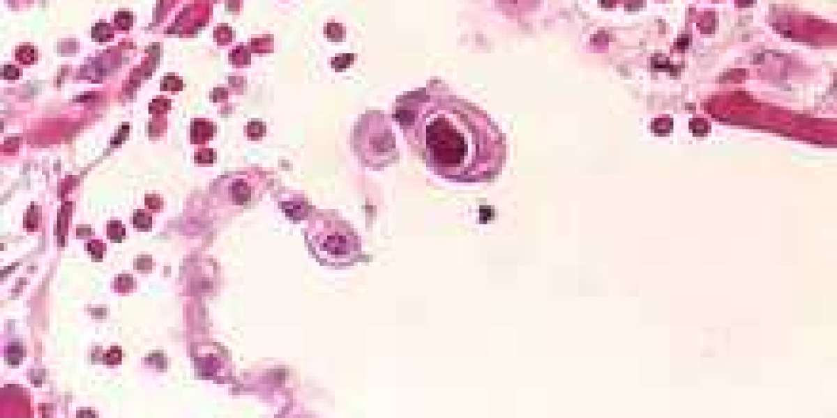 Size and Share of Cytomegalovirus Infections Market by 2033