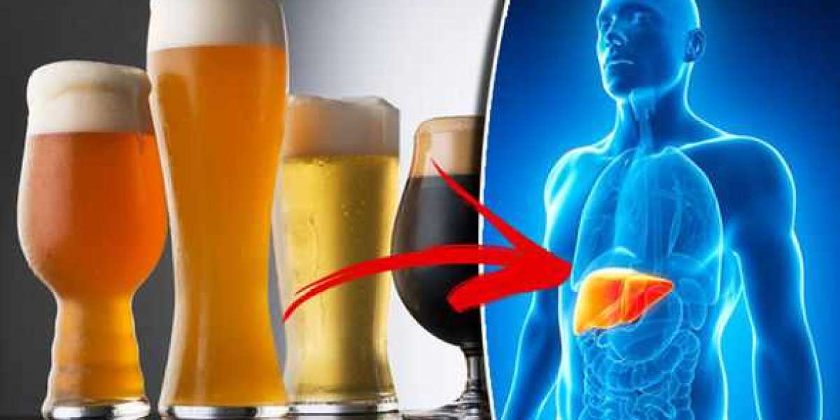 Alcoholic Liver Diseases Treatment Market size is expected to grow USD 3235.79 million by 2033
