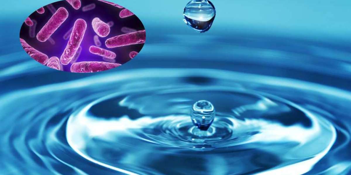 Legionella Testing Market Report, Size, Industry Share, Growth, Key Players Analysis, Forecast 2023-2028