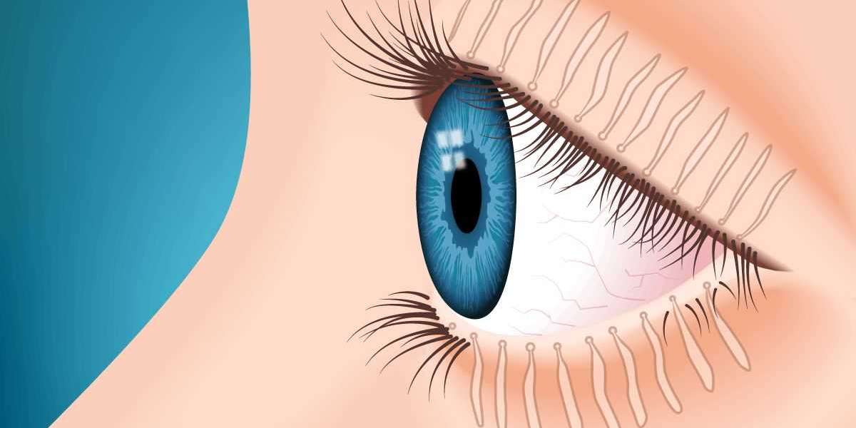 Meibomian Gland Dysfunction Market: Analysis of Epidemiology, Industry Trends, Size, Share, and Future Forecast (2023-20