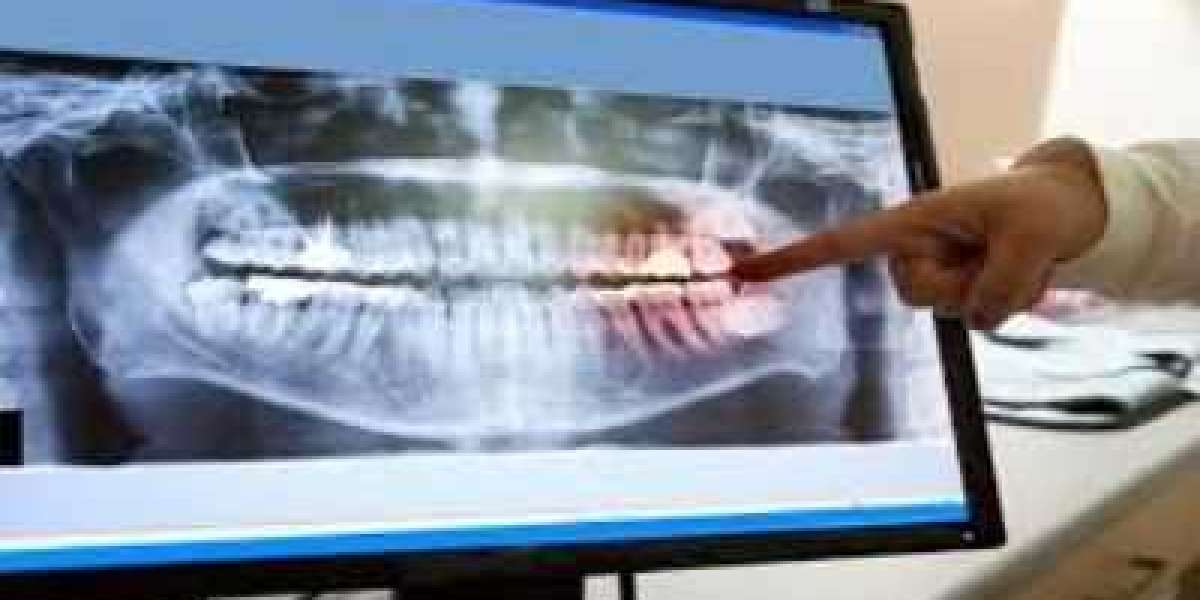 Dental Imaging Market Soars $4.23 Billion by 2030