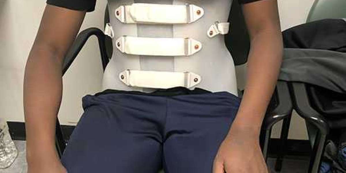Scoliosis Braces Market is Expected to Gain Popularity Across the Globe by 2033