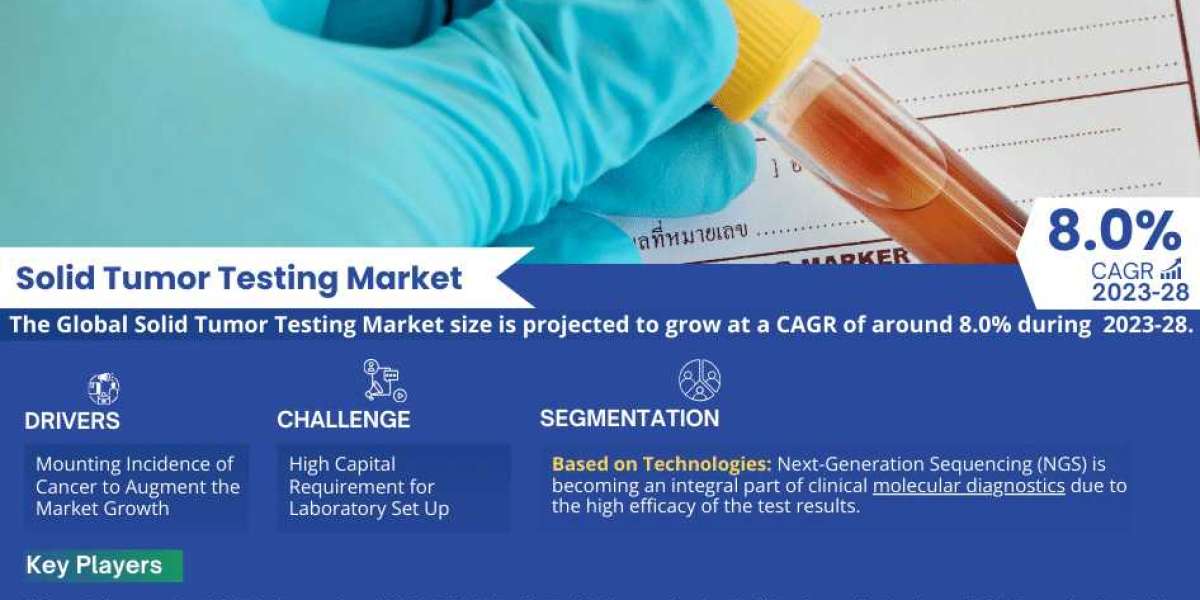 Solid Tumor Testing Market Trends, Sales, Top Manufacturers, Analysis 2023-2028