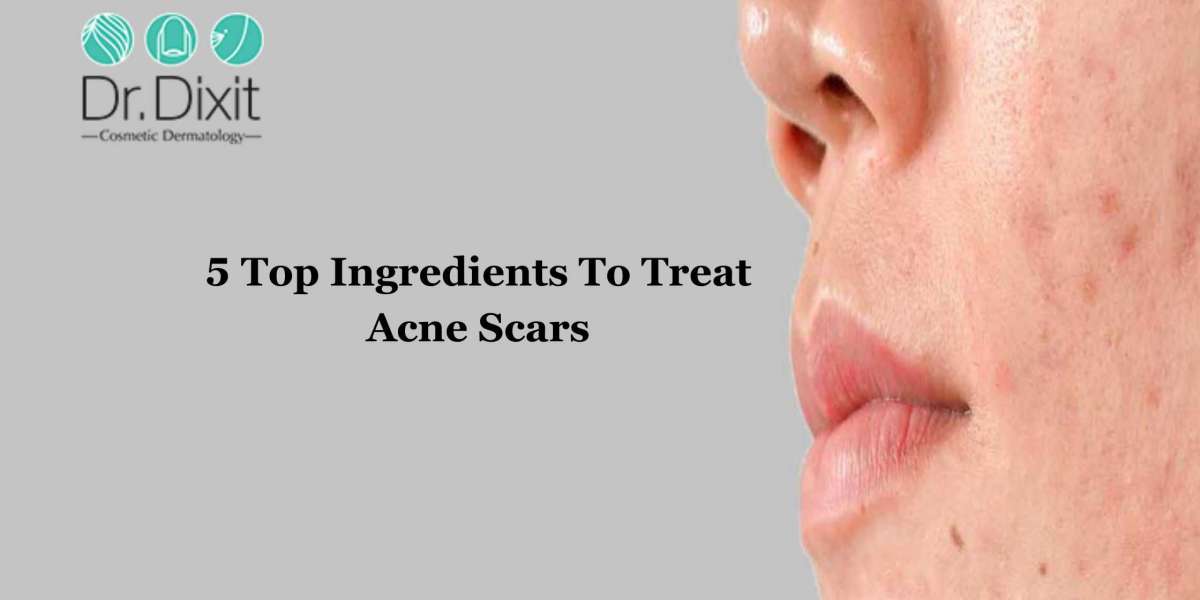What Is The Main Cause of Acne Scars?