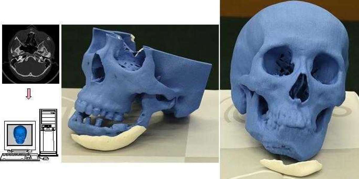 3D Printed Bones Market size is expected to grow at a CAGR of 4.7% from 2023 to 2033