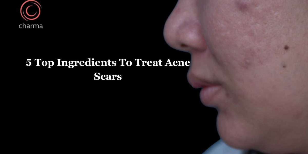 5 Top Ingredients To Treat Acne Scars