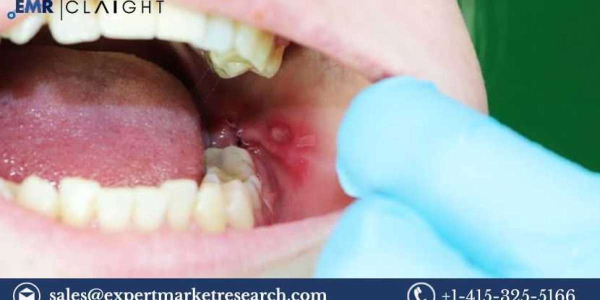 Mouth Ulcer Treatment Market, Emerging Trends, Key Players