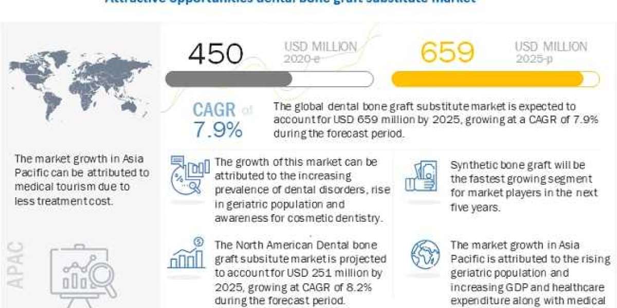 Global Dental Bone Graft Substitute Market Value, Volume, Key Players, Revenue and Forecasts to 2025