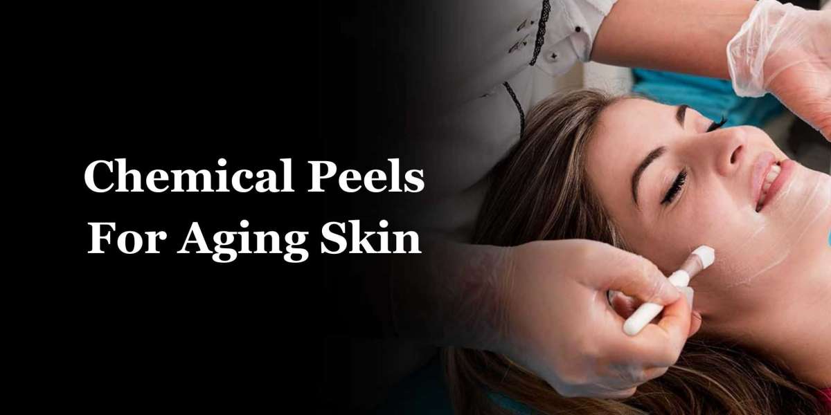 Chemical Peels For Aging Skin