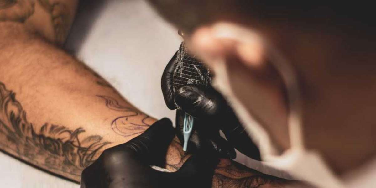 Revitalize Your Canvas: Tattoo Removal in NY