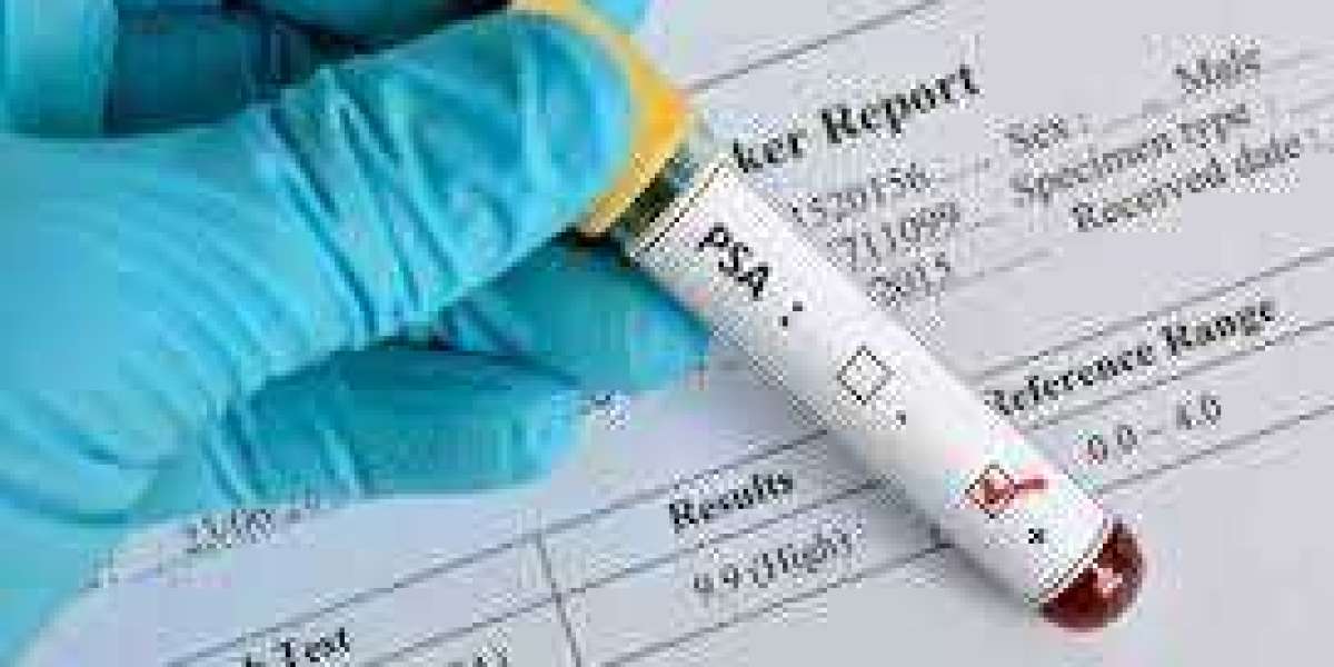 Prostate Specific Antigen Testing Market Size $7.74 Billion by 2030