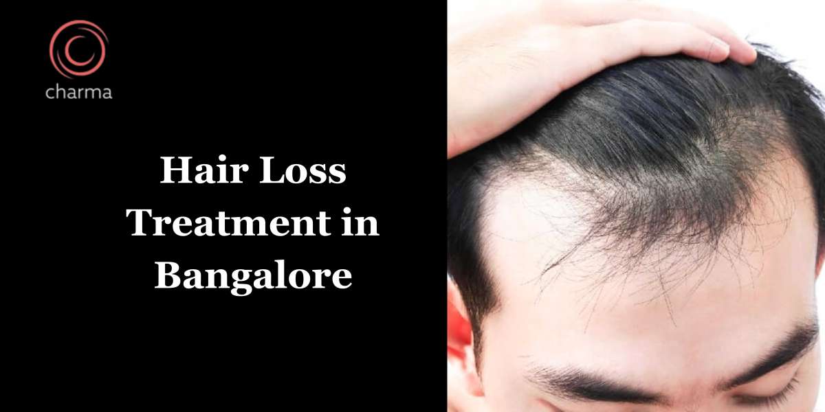 Here Are The 3 Most Popular Non-Surgical Hair Loss Treatments