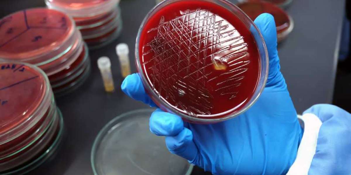 Blood Culture Tests Market Trends and Dynamics by 2030