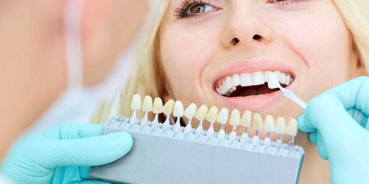 A Guide to Achieving the Perfect Smile with a Cosmetic Dentist in Stamford