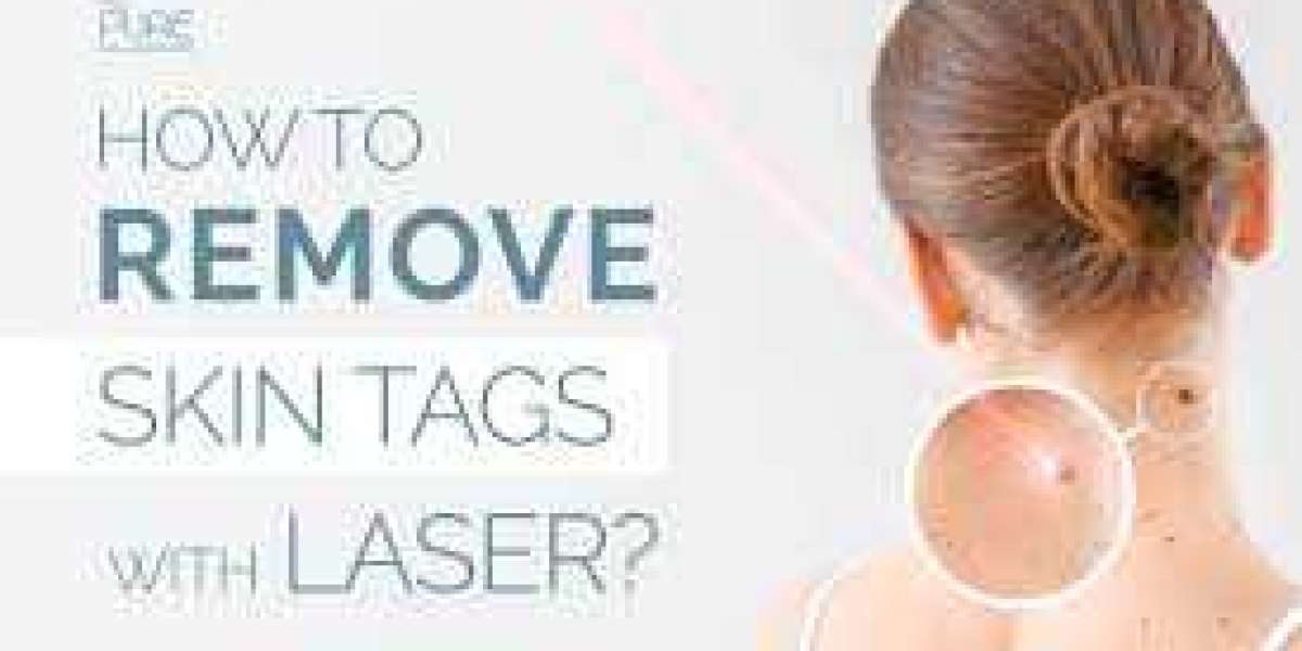 Tag Away Pro Skin Tag Remover Ingredients