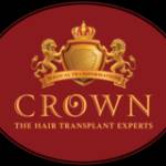 Crown Hair Transplant Experts