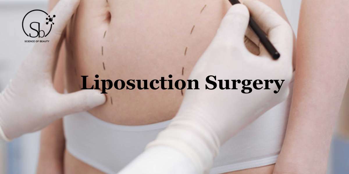 Liposuction For Lipedema: Everything One Needs to Know