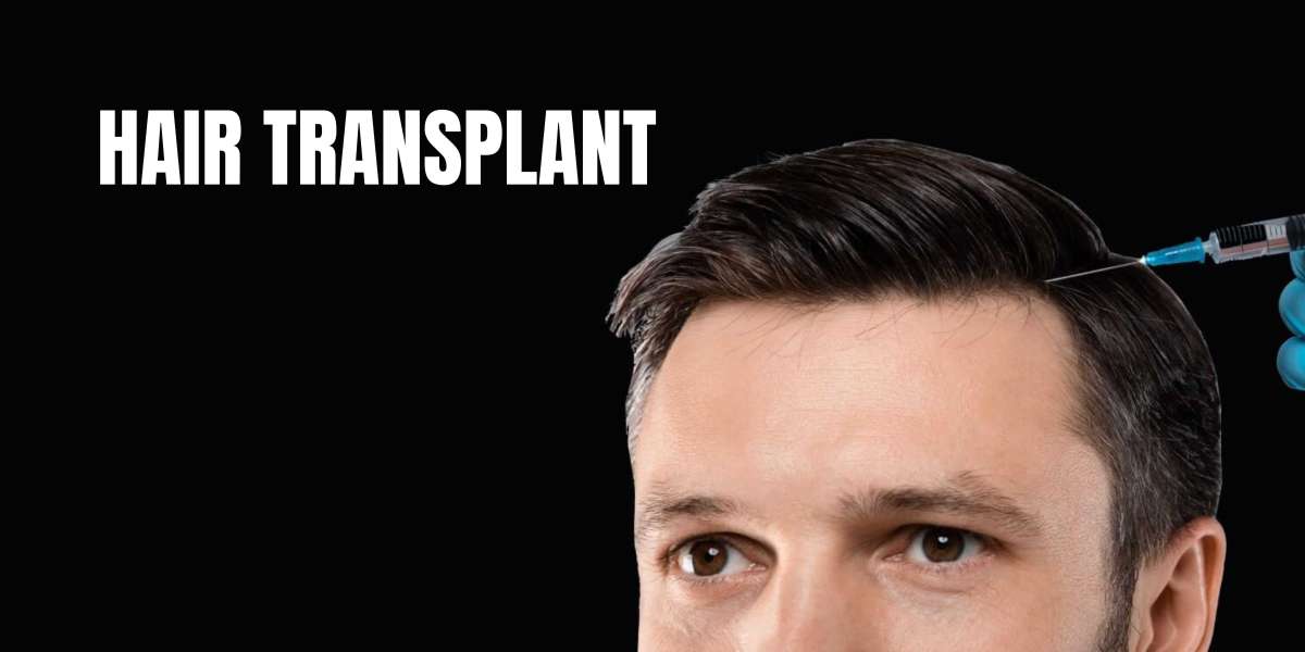 Hair Transplant Falling Out After 1 Year: What To Do Next