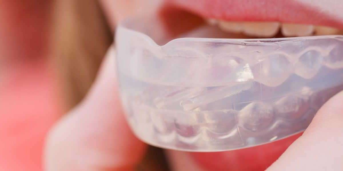 Protect Your Smile: The Ultimate Guide to Choosing the Right Mouthguard