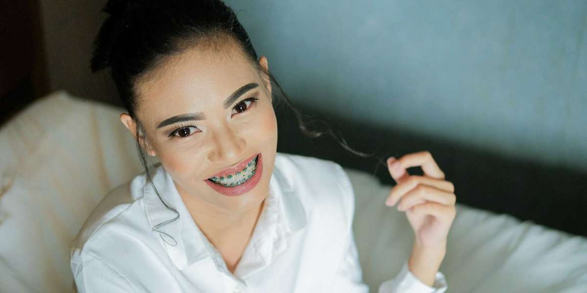 Benefits of Affordable Braces in Dubai for Adults and Teens
