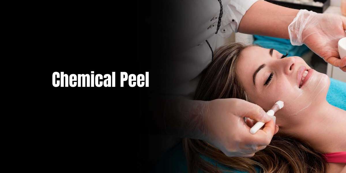 Chemical Peels: Types and Procedure