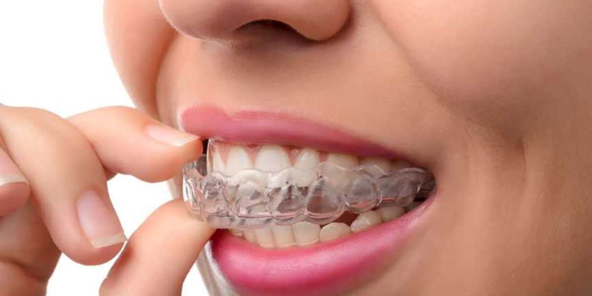 Don’t Hide your Smile – Straighten your Teeth with Invisalign