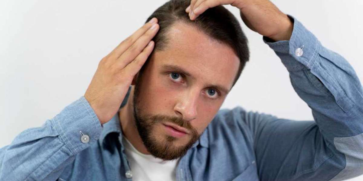 The Ultimate Guide to Hair Loss Treatment