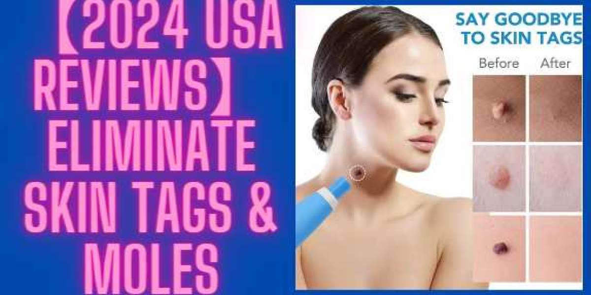 Full Body Skin Tag Remover Imperfection (Skin Tag Or Mole)
