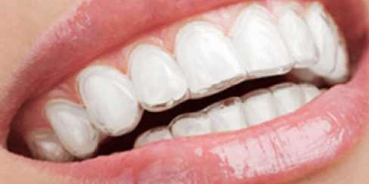 Teeth Extractions NYC