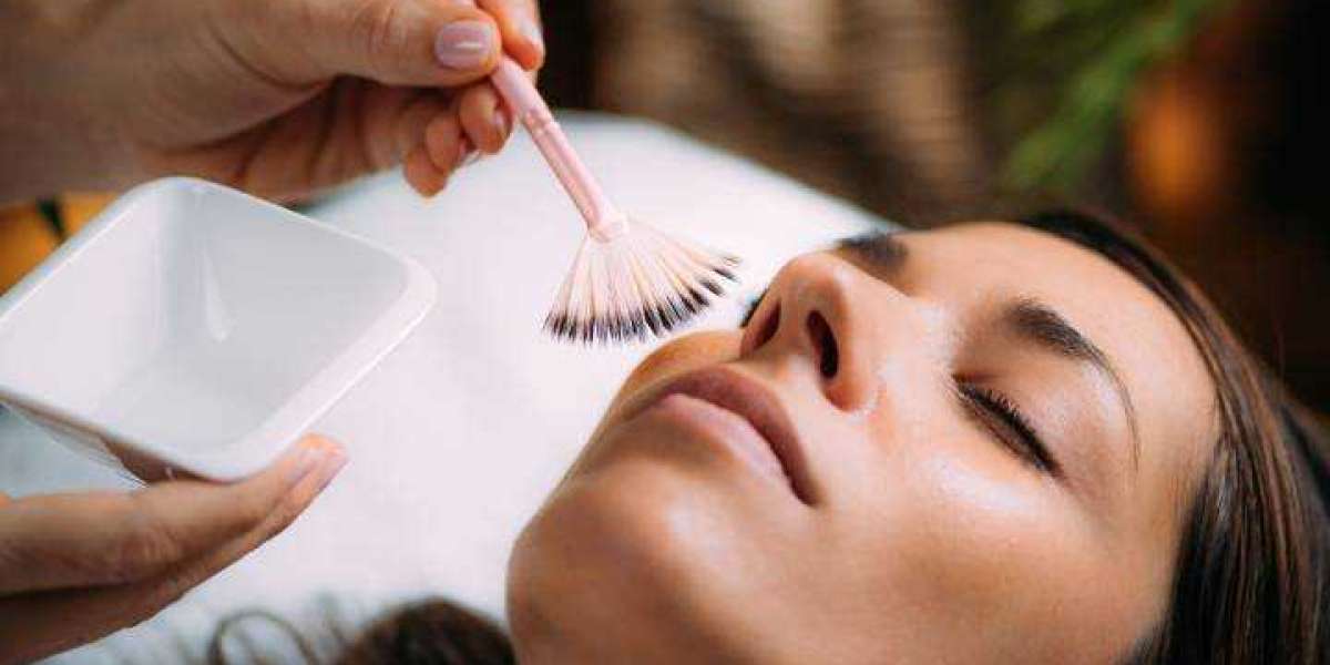 How Do Chemical Peels Help Remove Acne Scars?