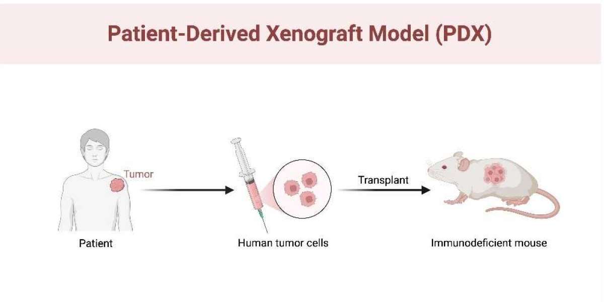 From Bench to Bedside: The Rise of Patient-Derived Xenograft Models in Cancer Research
