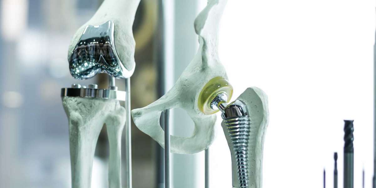 From Hips to Knees to Spines: Biomaterials Address Diverse Orthopedic Needs