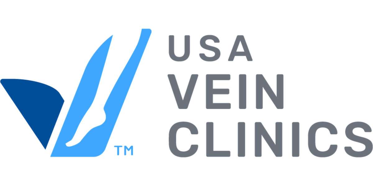 Varicose Vein Treatment Cost